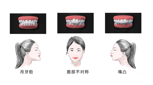 牙齿矫正